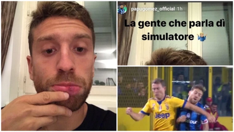 Gomez mostra il labbro gonfio: "La gente che di simulatore"