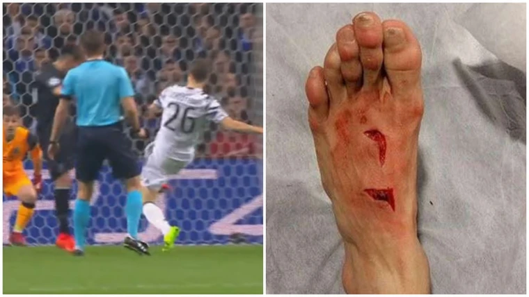 Lichtsteiner, intervento killer su Herrera: 17 punti di sutura per il messicano